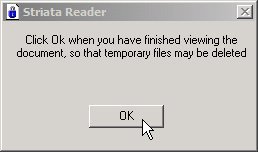 striata-reader-delete-temporary-files.jpg